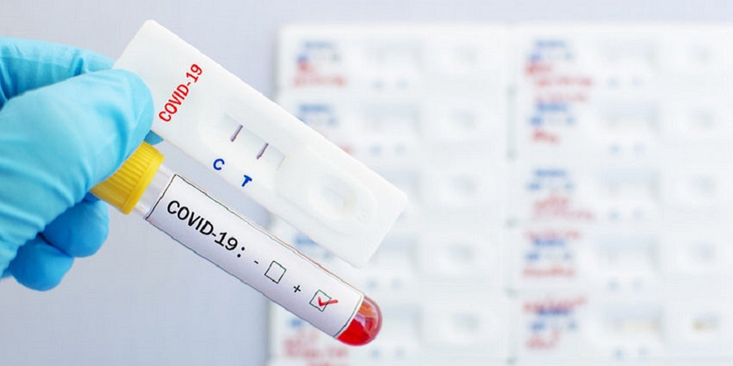 Corona Schnelltest